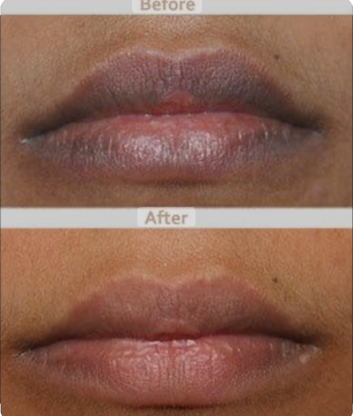 Lip Lightening Scrub