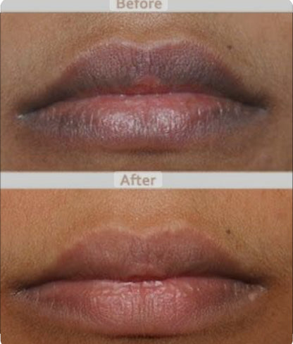 Lip Lightening Scrub
