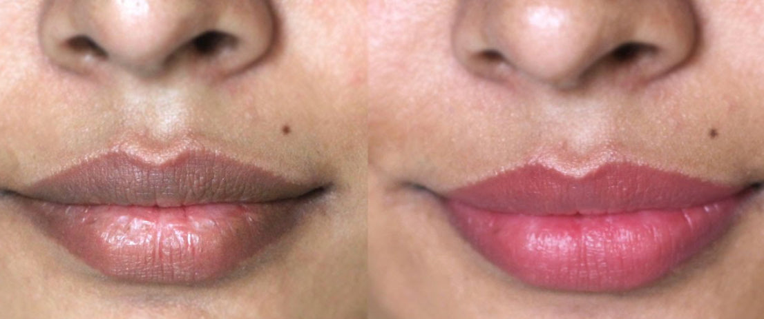 Lip Lightening Scrub