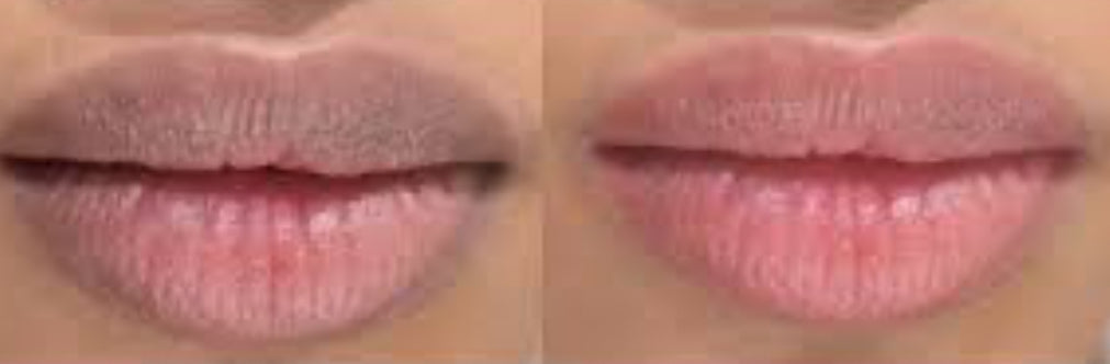 Lip Lightening Scrub